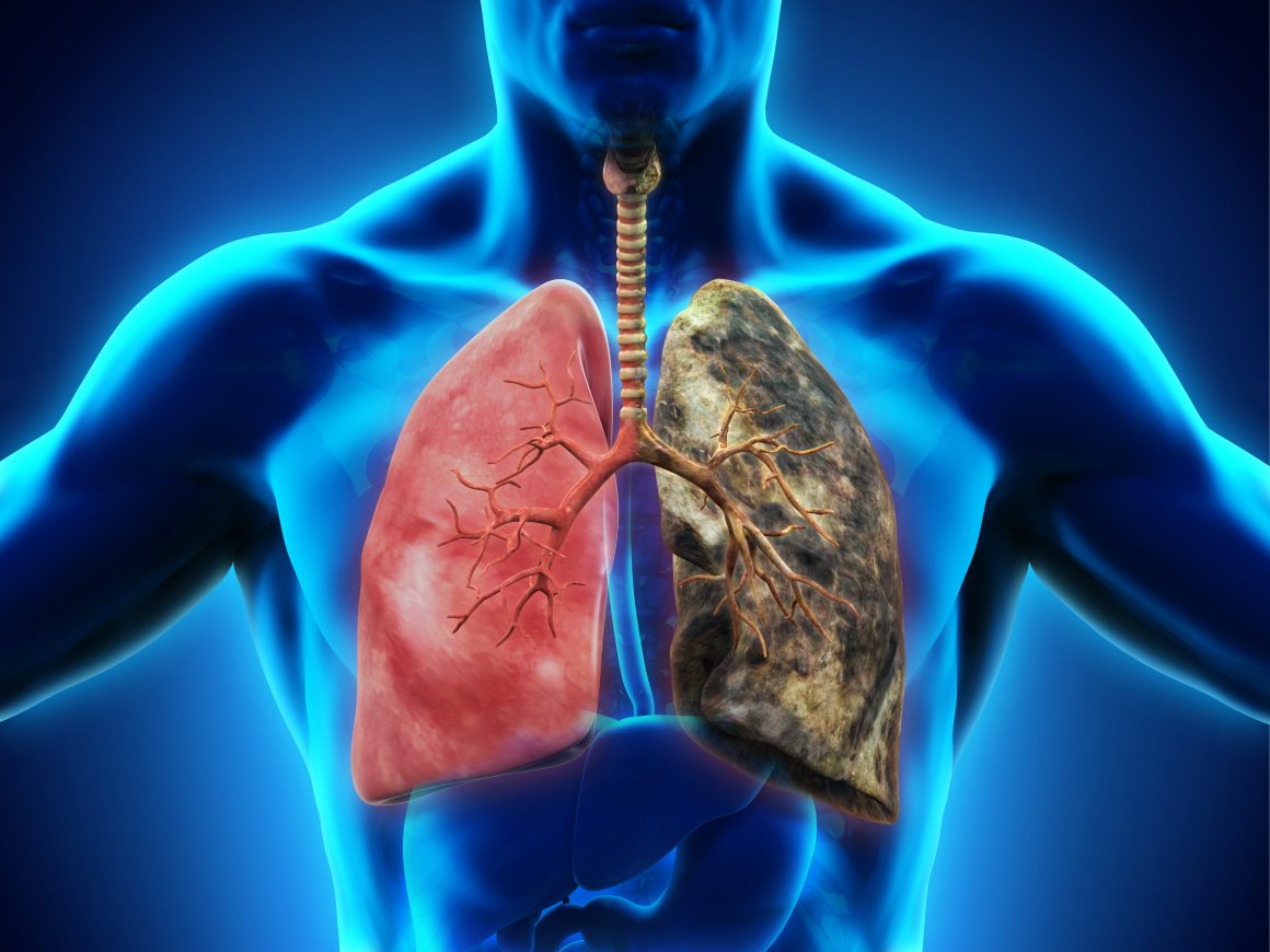 Celulas-tronco-podem-ajudar-em-tratamentos-com-doenças-no-pulmão.jpeg