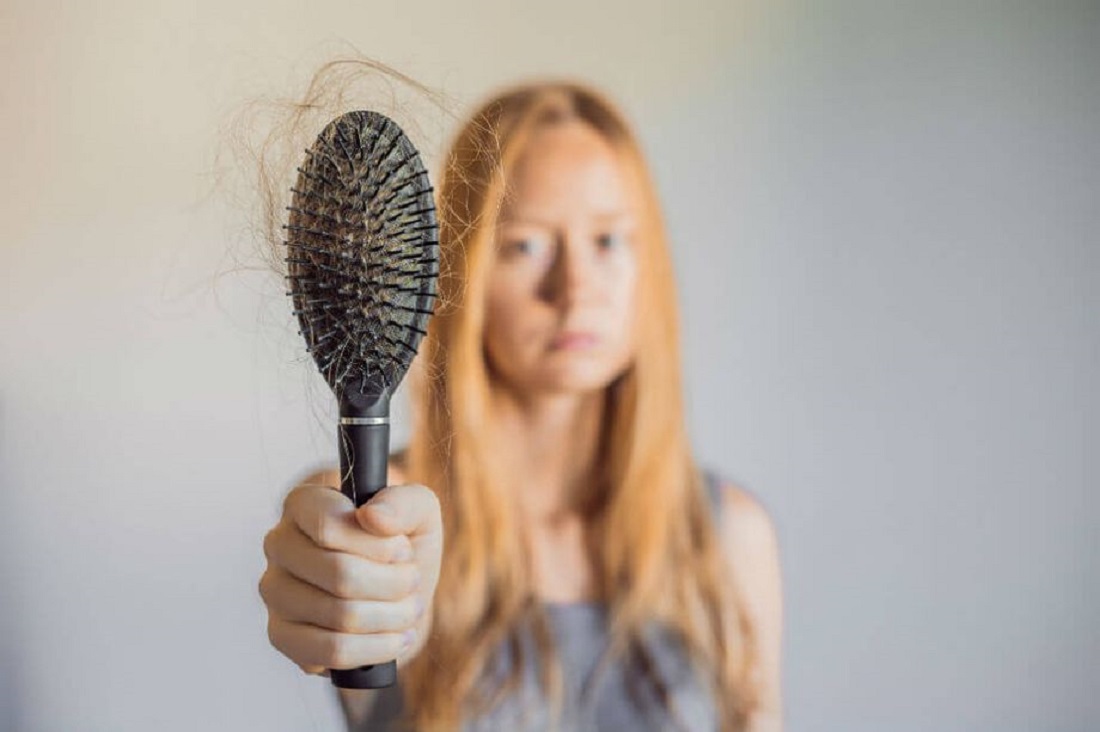 hair-loss-1.jpg