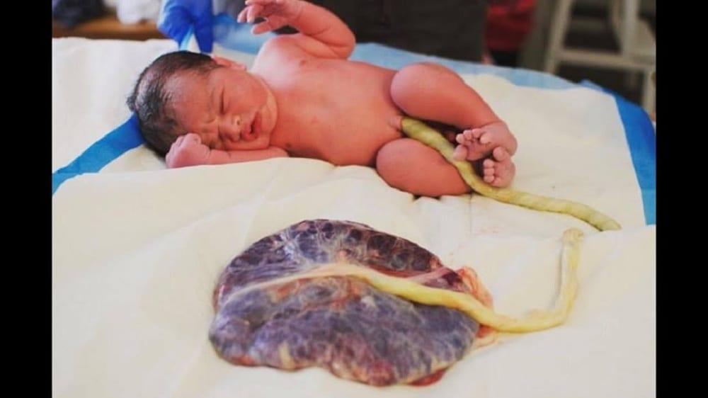 placenta.jpg